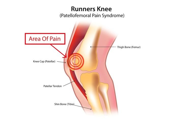 nc blog how to relieve knee pain